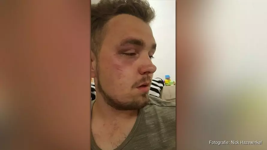 Mishandelde man uit Noord-Scharwoude na dagen ontslagen uit ziekenhuis